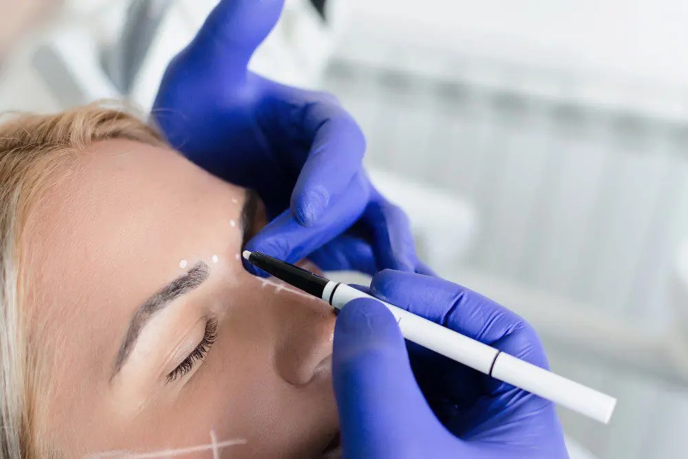 Koliko traje 'botox'?